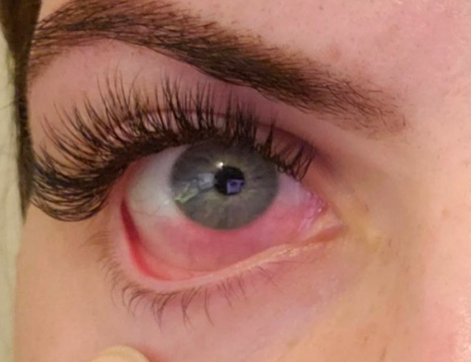 Minimizing Irritation in Your Lash Application